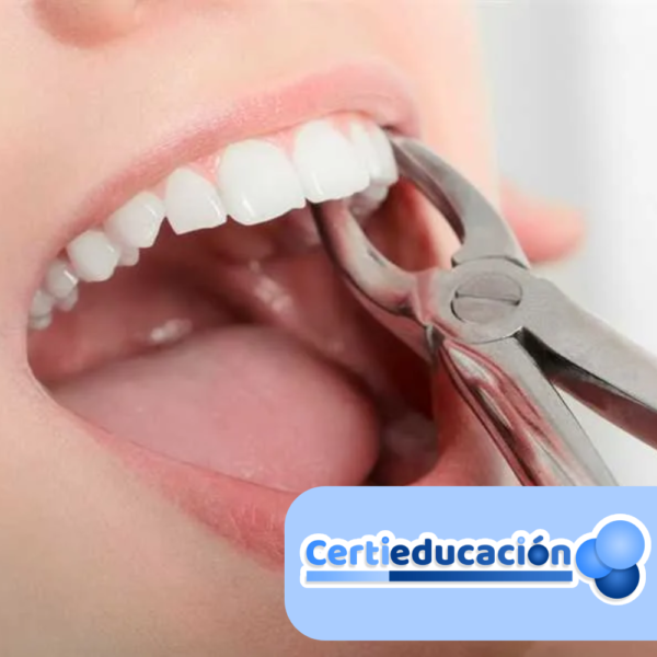 Periodoncia (Enfermedades de las Encías)